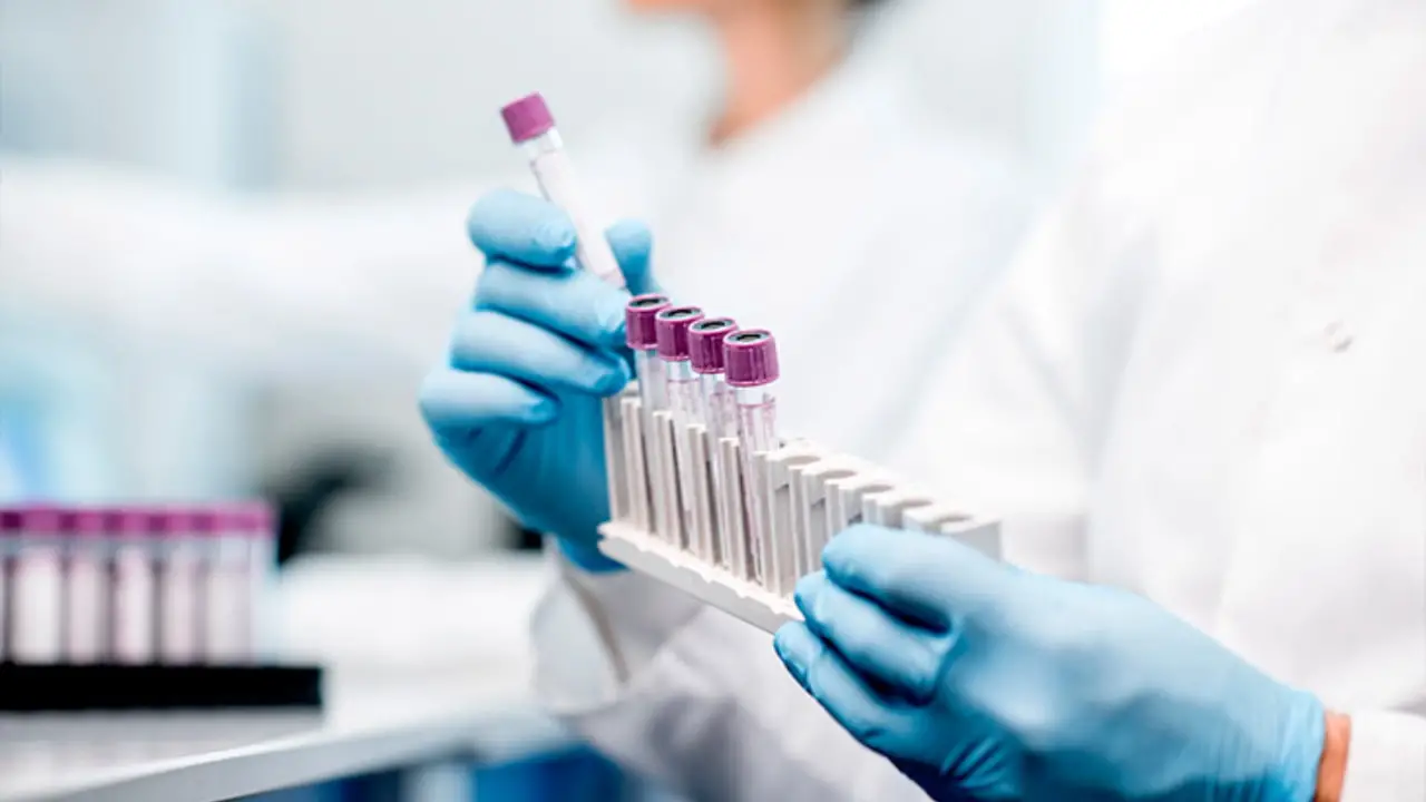 Amostras de humanos que tiveram contato com aves contaminadas serão analisadas em laboratório. 