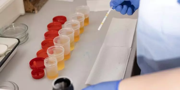 Reino Unido detecta gripe aviária em ovelha pela primeira vez