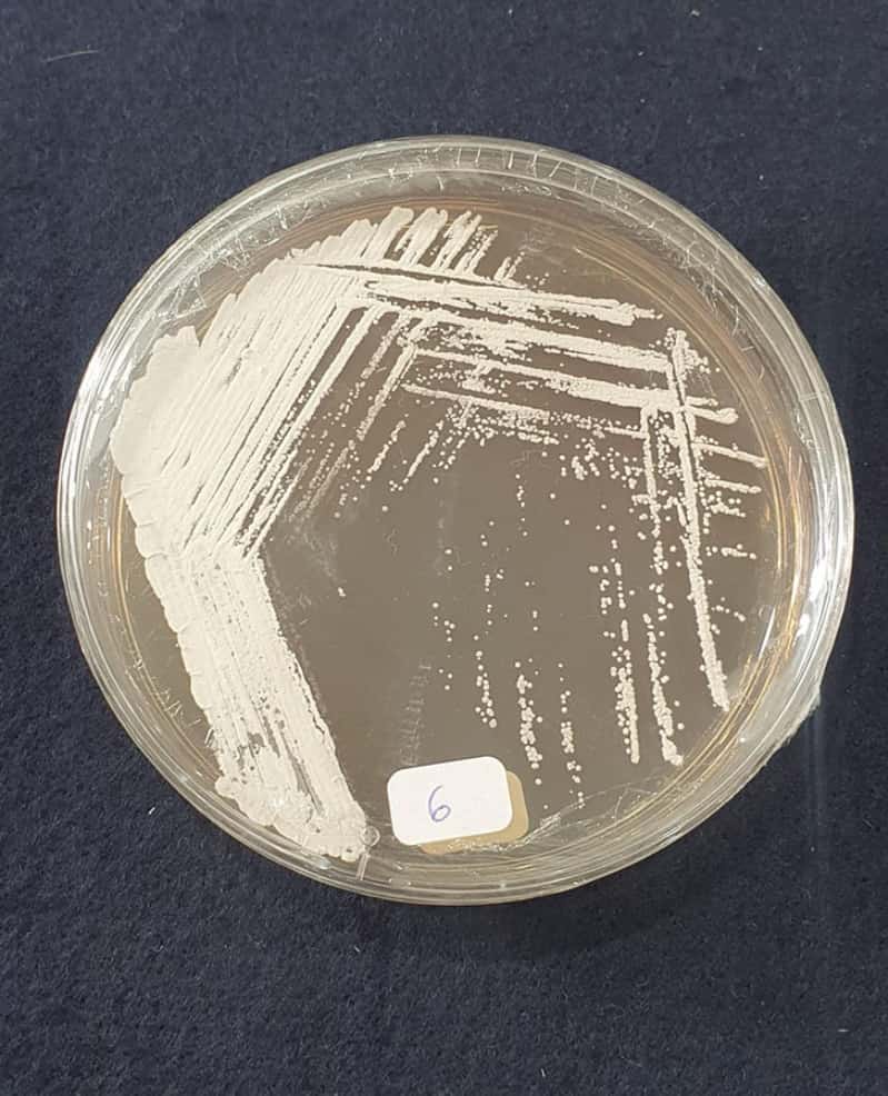 Bactéria da Caatinga abre caminho para bioherbicida eficaz contra a buva 2 Bactéria da caatinga